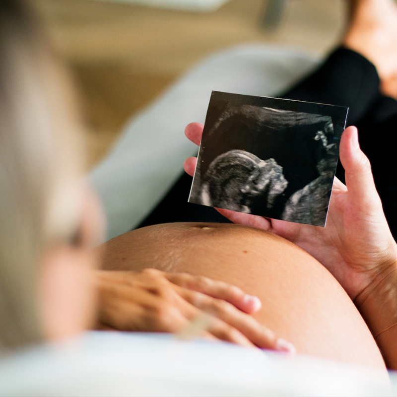 Mão segurando ultrassonografia com o perfil de um bebê apoiada numa barriga de gestação