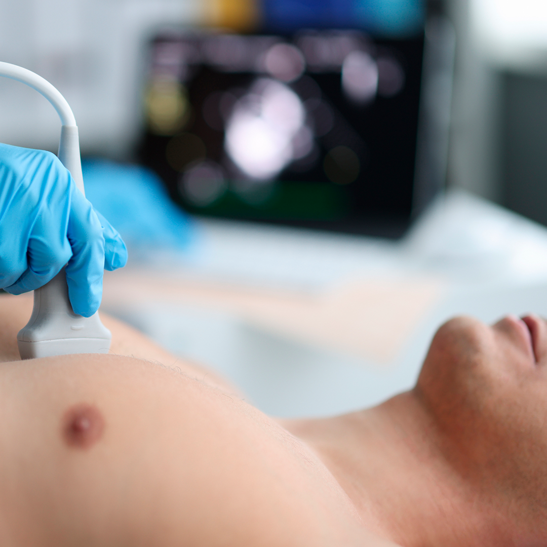 5 Atitudes Indispensáveis no Cuidado com as Mamas: homem fazendo ultrassom da mama